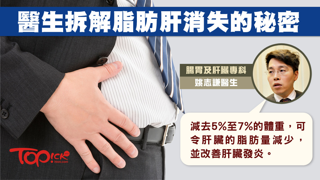 脂肪肝会增加患癌风险 医生:治疗首要减去5%至7%体重-汇美优普-热门搜索话题榜